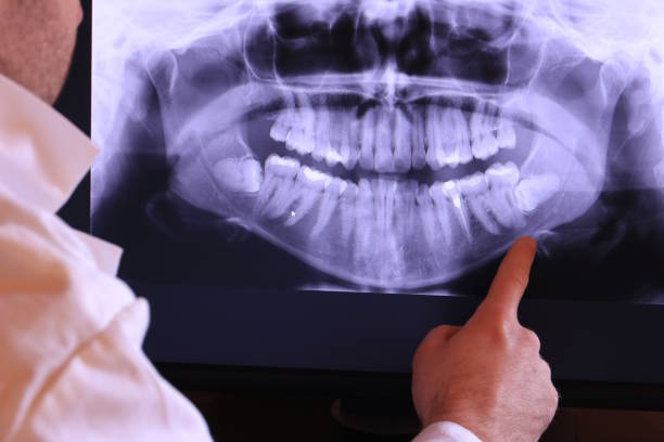 Best Emergency Cosmetic Dentistry (e.g., broken veneers) in Winfield, KS