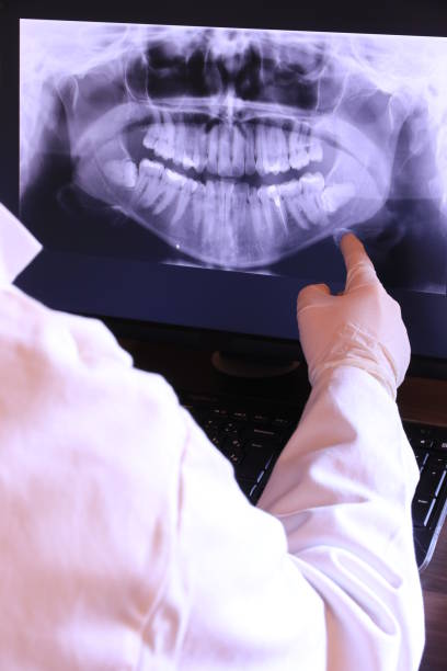 Best Emergency Dental Care for Sports Injuries in Winfield, KS